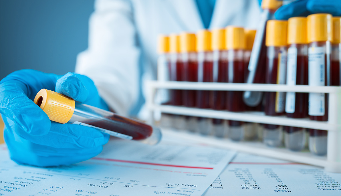 Close-up of gloved lab technician handling sealed vials of blood