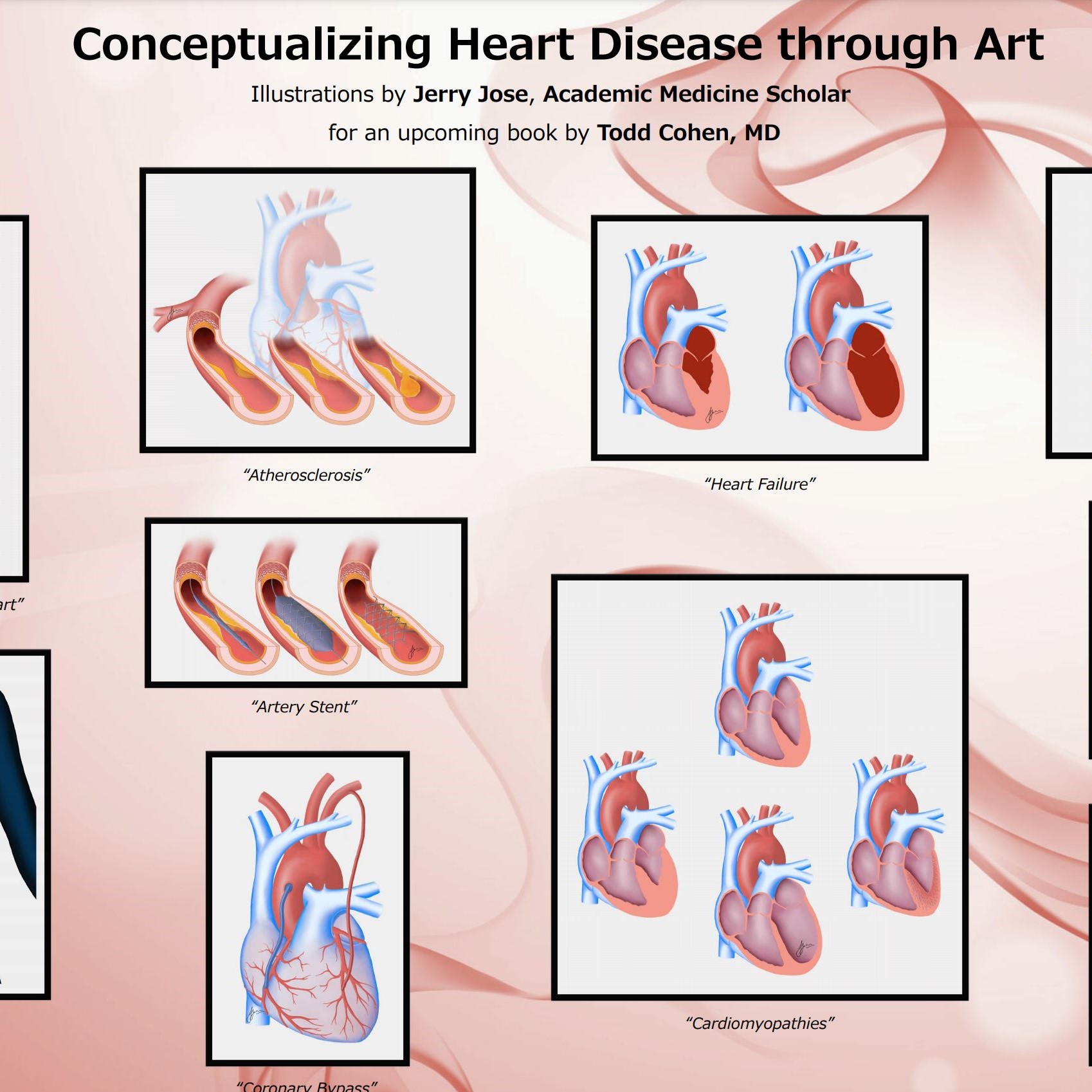 Conceptualizing Heart Disease through Art