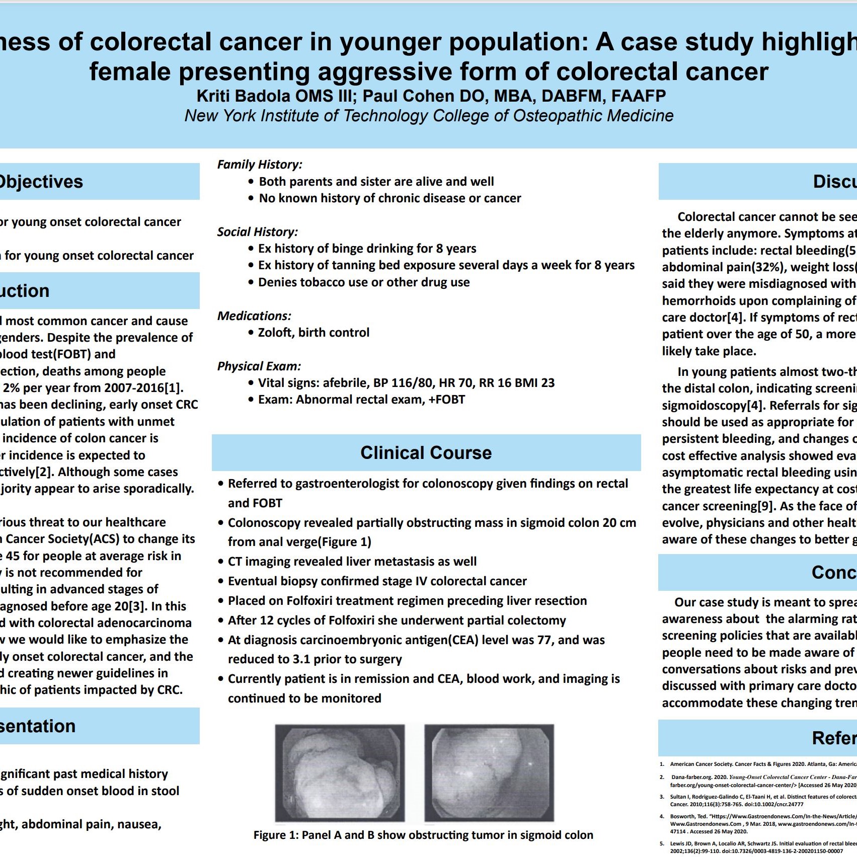 Increase awareness of colorectal cancer in younger population: A case study highlighting 29 year old
	female presenting aggressive form of colorectal cancer
