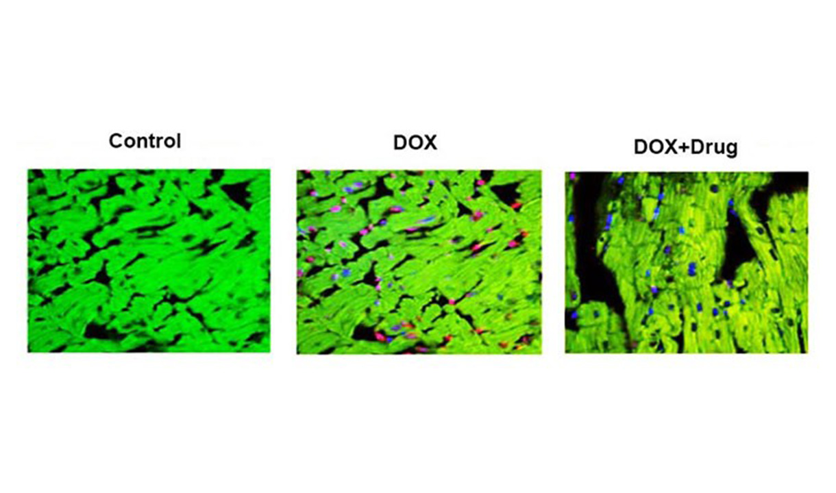 This Figure Shows Heart Sections From Animals Treated With Dox And A Drug. Dox Alone Induces The Death Of Cardiac Myocytes, Indicated By The Red Dots In The Middle Panel. However, Treatment With The Drug Abolishes Dox’s Ability To Cause Cell Death, As Shown In The Right Panel.